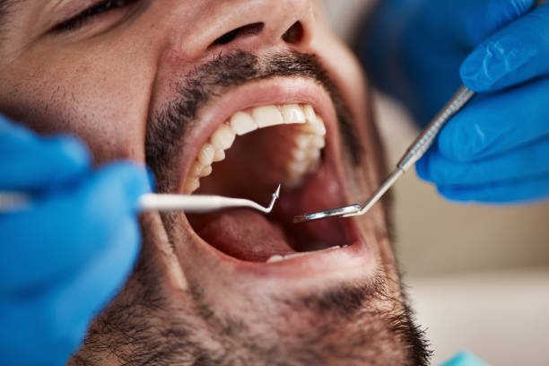 Best Broken or Cracked Tooth Emergency Dentist in Hollywood, FL